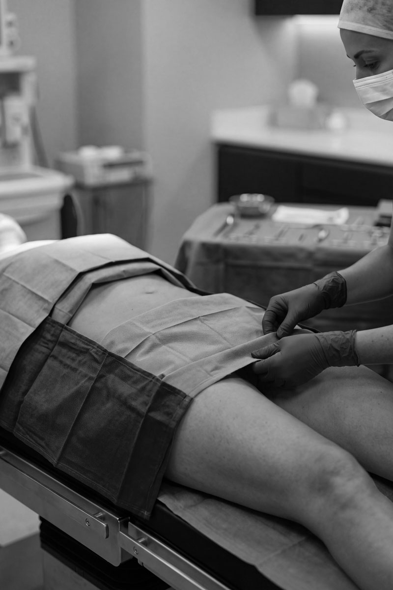 lapioplastia Cirugía estètica labios menores labioplastia en Madrid